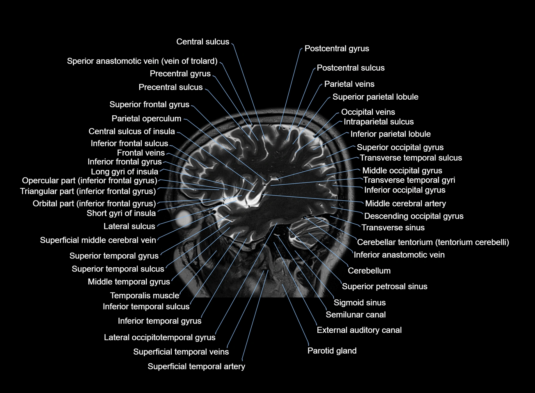 brain sagittal anatomy 3T MRI images -img-00001-00015.webp